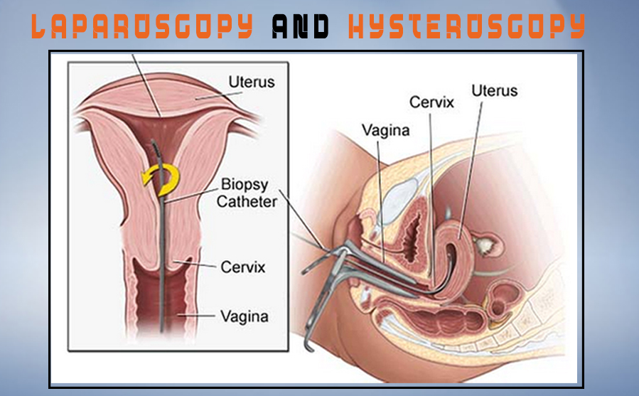 Laparoscopy and Hysteroscopy Surgeries